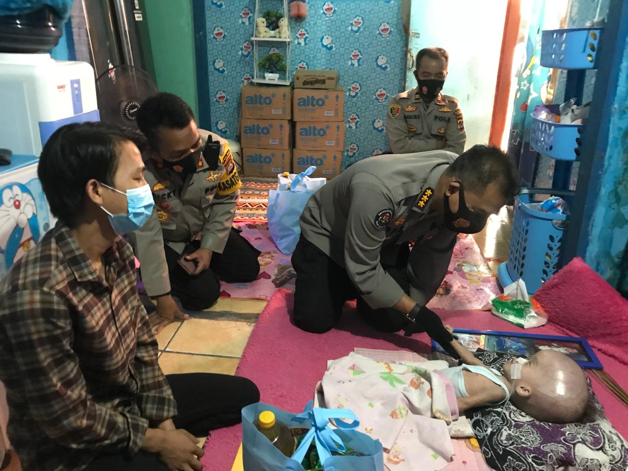 Polda Banten Peduli, Kunjungi Dan Bantu Balita Penderita Hydrocephalus Di Serang
