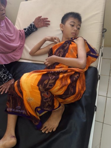 Mari Ulurkan Tangan, Bocah 13 Tahun Asal Mesuji Derita Leukimia