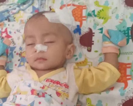 Kendala Biaya, Bayi Usia 8 Bulan Harus Berjuang Untuk Melawan Penyakit Bocor Jantung